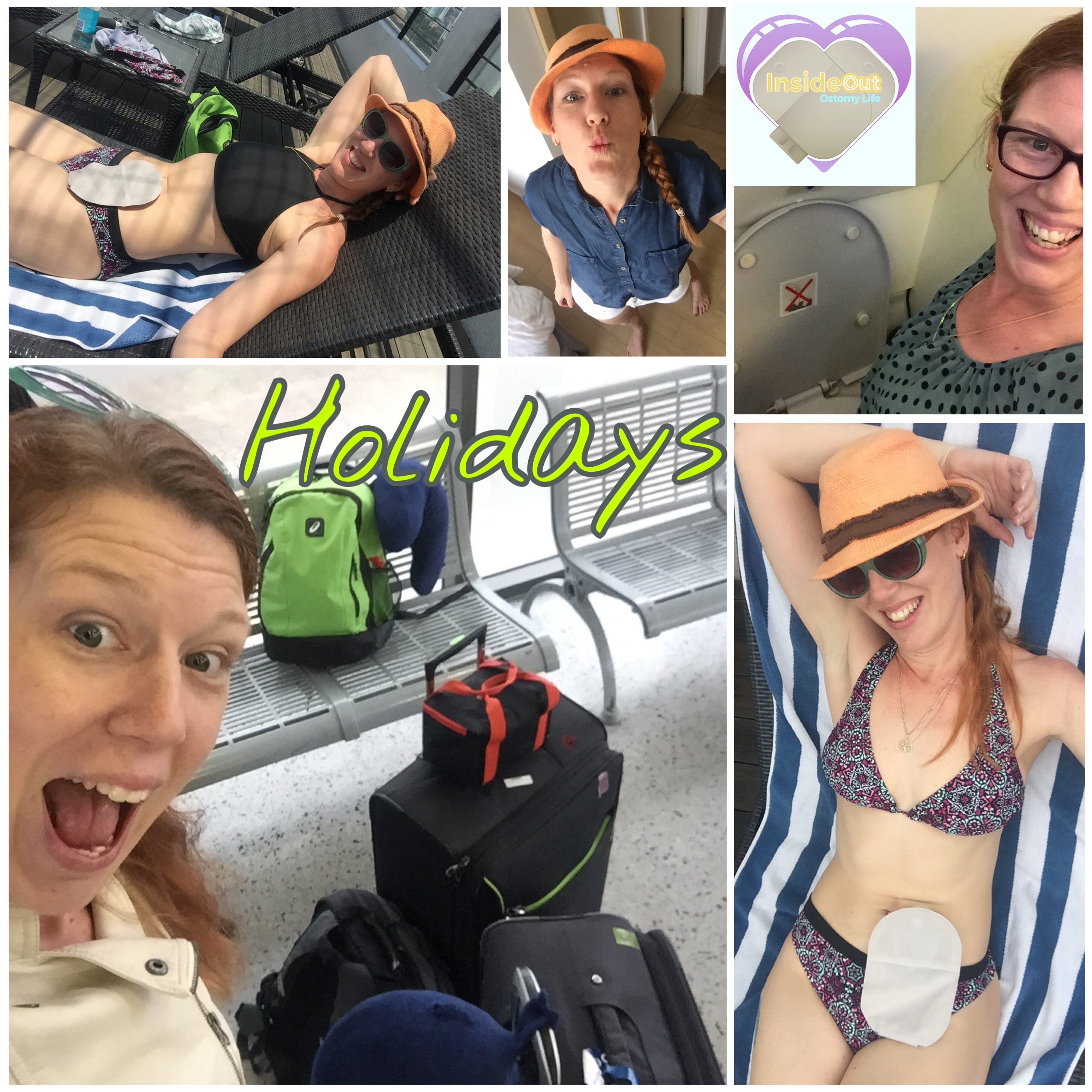 My Survival Story - Living With An Ileostomy Bag 